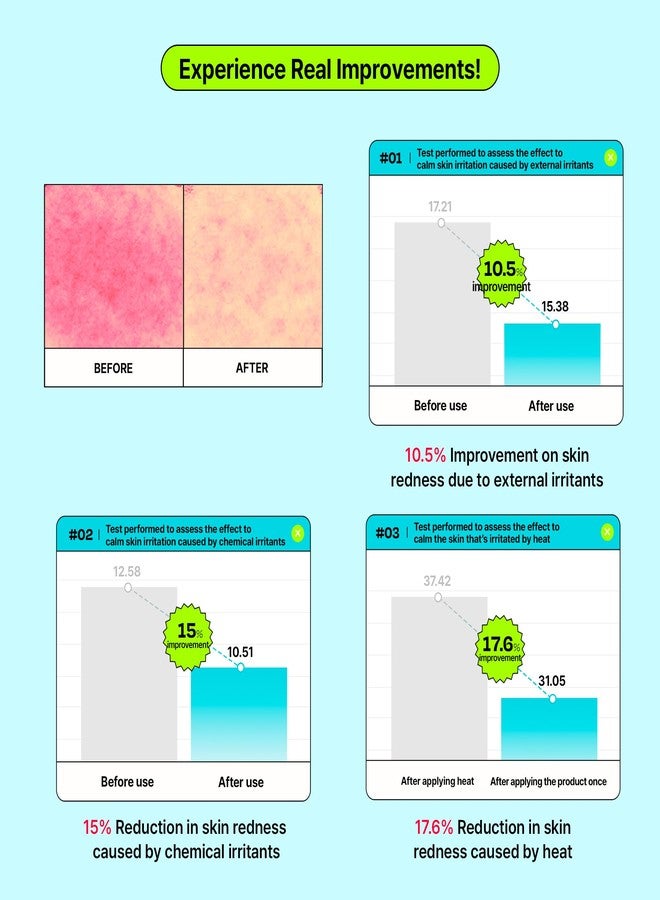 EDIT.B Calming Tok Cica Heartleaf Cream, Instant Cooling & Deep Hydrating Facial Cream for Sensitive Skin, Lightweight Soothing & Relief Moisturizer, Korean Daily Skin Care (3.38 fl.oz. / 100ml) - Image 4